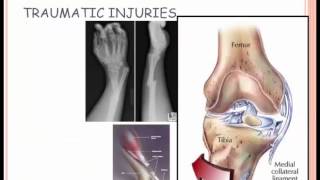 Musculoskeletal Conditions Part 1