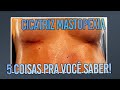 CICATRIZ DE MASTOPEXIA 5 PERGUNTAS QUE SEMPRE RECEBO I CIRURGIA PLÁSTICA