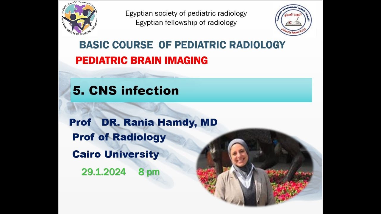 CNS Infections in Pediatrics