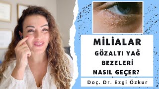 Milialar Nedir? - Göz Altı Yağ Bezeleri - Yağ Kistleri Çözümü