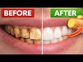 Improve Your Smile Naturally | Quick Home Care Routine