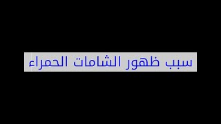 سبب ظهور الشامات الحمراء