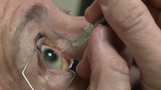 Eyeball injections equal eye-popping profits