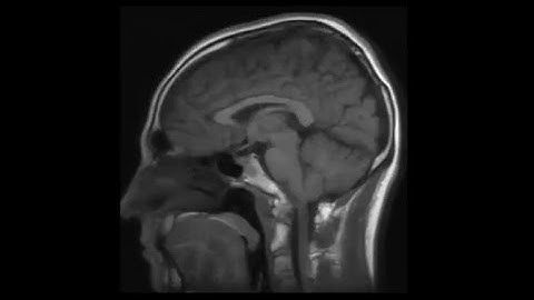 How to 3D print your brain