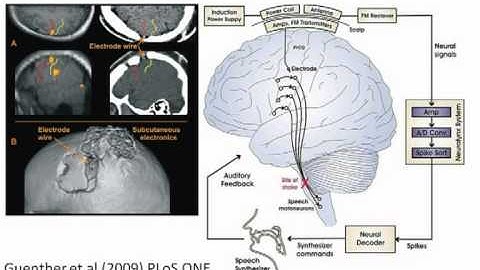Speech Synthesizer operated by the Brain - by Professor Keith Kendrick