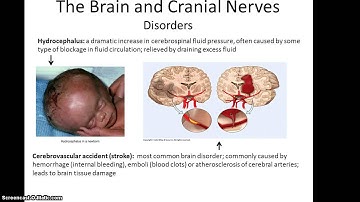 Anatomy 32 Lecture, Chapter 18 part 1