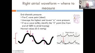 The "Right" Way To Do A Right Heart Catheterization | Ryan Tedford