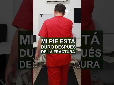 Pie duro después de una fractura #feibian #fracturadetobillo #fractura #tobillo #fplg #feibianfisio