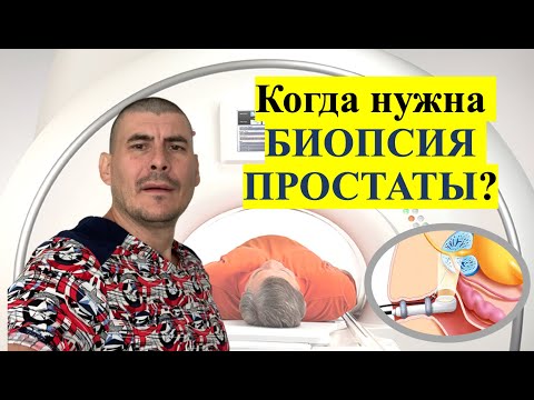 БИОПСИЯ ПРОСТАТЫ. КОГДА НУЖНА? КАК ВЫПОЛНЯЕТСЯ? ОСЛОЖНЕНИЯ!!!