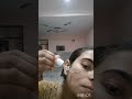 3rd day of microneedling #microneedling #6monthtransformation #viralvideo #fromstruggletostrength