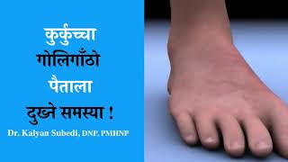 Achilles Tendinitis Sprained Ankle, Bursitis कुर्कुच्चा पैताला आदि दुख्ने समस्या! Dr.kalyan Subedi