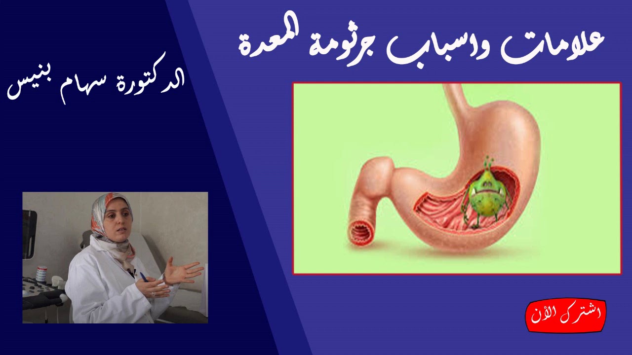 علامات واسباب جرثومة المعدة وطرق العلاج الدكتورة سهام بنيس