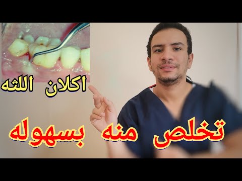 فيديو: كيفية إزالة مركز الطماطم: 11 خطوة (بالصور)