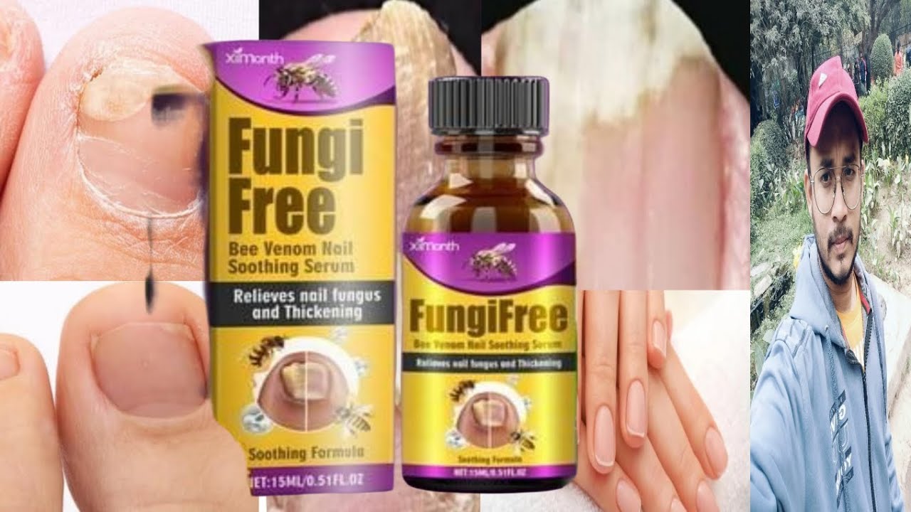 Fungi Free Bee Venom Nail Soothing Serum | Honest Review