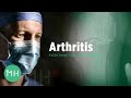 What is Arthritis? | Everything You Need to Know About Arthritis