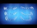 Straight Talk About Crooked Teeth | Invisalign