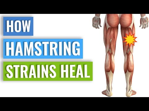 वीडियो: खींची हुई हैमस्ट्रिंग मांसपेशी का इलाज कैसे करें (चित्रों के साथ)