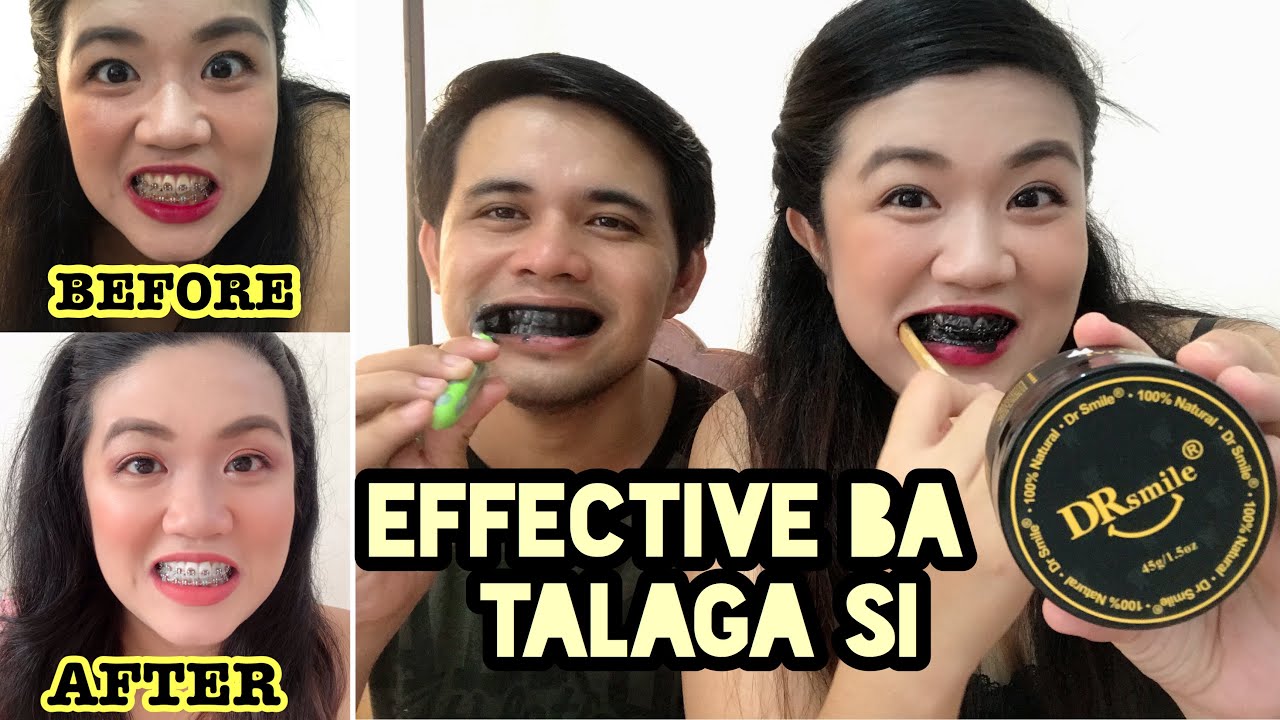 PAANO PUMUTI ANG NGIPIN? DR. SMILE 2WEEKS RESULT!! - YouTube