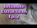 Intimate Extractions Ep. 2 | Bk Beauty Spa