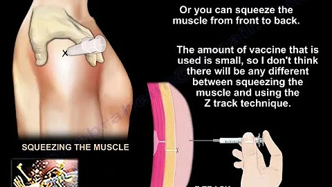 Anatomy of Deltoid Muscle ,deltoid  Vaccination  - Everything You Need To Know - Dr. Nabil Ebraheim