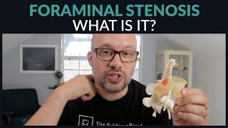 What is Foraminal Stenosis?