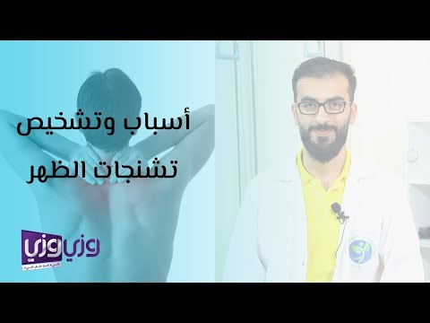 فيديو: ما هو تشنج الظهر؟