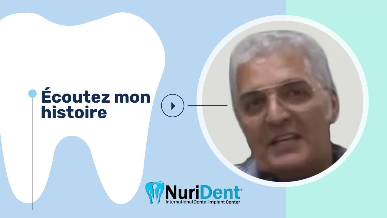 Mise en place immédiate avec des implants basaux à la clinique dentaire NuriDent!