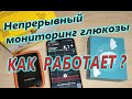 FreeStyle Libre. Что такое непрерывный мониторинг глюкозы? Как работает? Что для этого нужно?