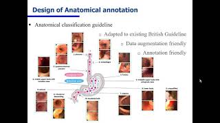 [IPCAI 2020] Deep learning-based anatomical site classification for upper gastrointestinal endoscopy