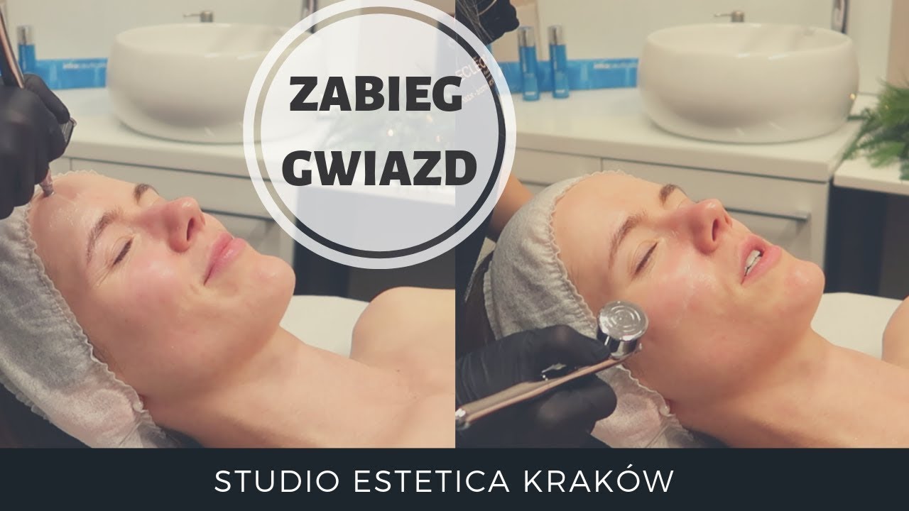 ZABIEG GWIAZD INTRACEUTICALS ⭐️ YouTube