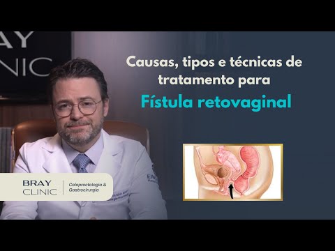 Vídeo: Fístula Retovaginal: Causas, Sintomas e Tratamentos