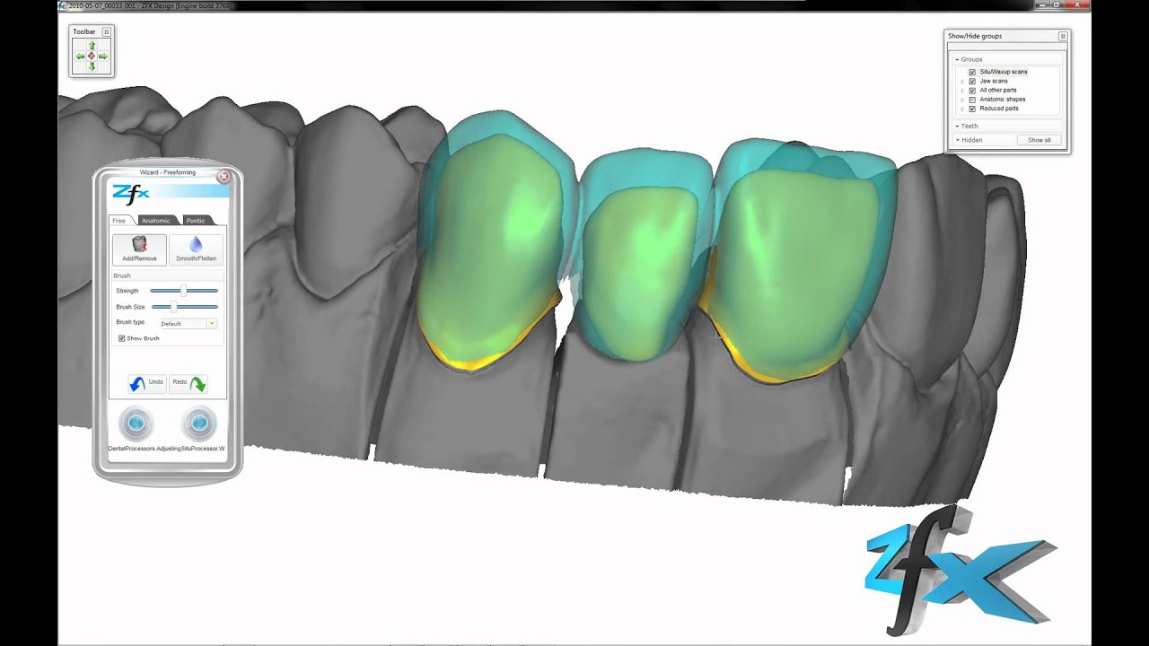 Zfx CAD Software - Situation