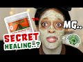 [Honest Review] 14 days WITH Aztec Secret Indian Healing Clay Mask