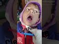 ##Cleft Palate # Awareness