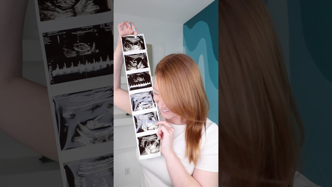 IM HAVING A BABY!! 🍼
