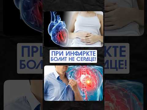 Инфаркт без боли: 40% людей не чувствуют главный симптом! #ВасилийКоролишин #здоровье #сердце