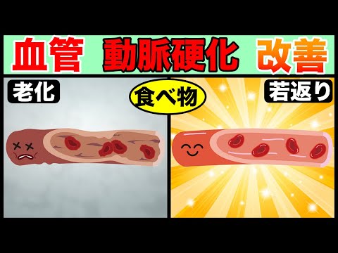 【40歳以上必見！】動脈硬化を改善する食べ物とは！？