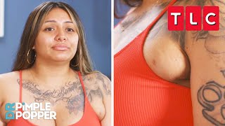 This Woman Has Two Extra Boobs!? | Dr. Pimple Popper | TLC