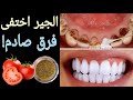 أقسم بالله لن تحتاج للذهاب إلى طبيب الأسنان لتبييض الأسنان وإسقاط الجير سيسقط لوحده بدون رجعة