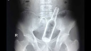 ИНСОН ОРГАНИЗМИДАН ОЛИНГАН НОЕБ БУЮМЛАР