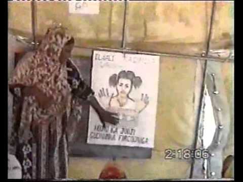 Infibulation Means Female Genital Mutilation (FGM) NHS