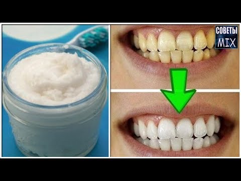 Как отбелить желтые зубы в домашних условиях для белоснежной улыбки
