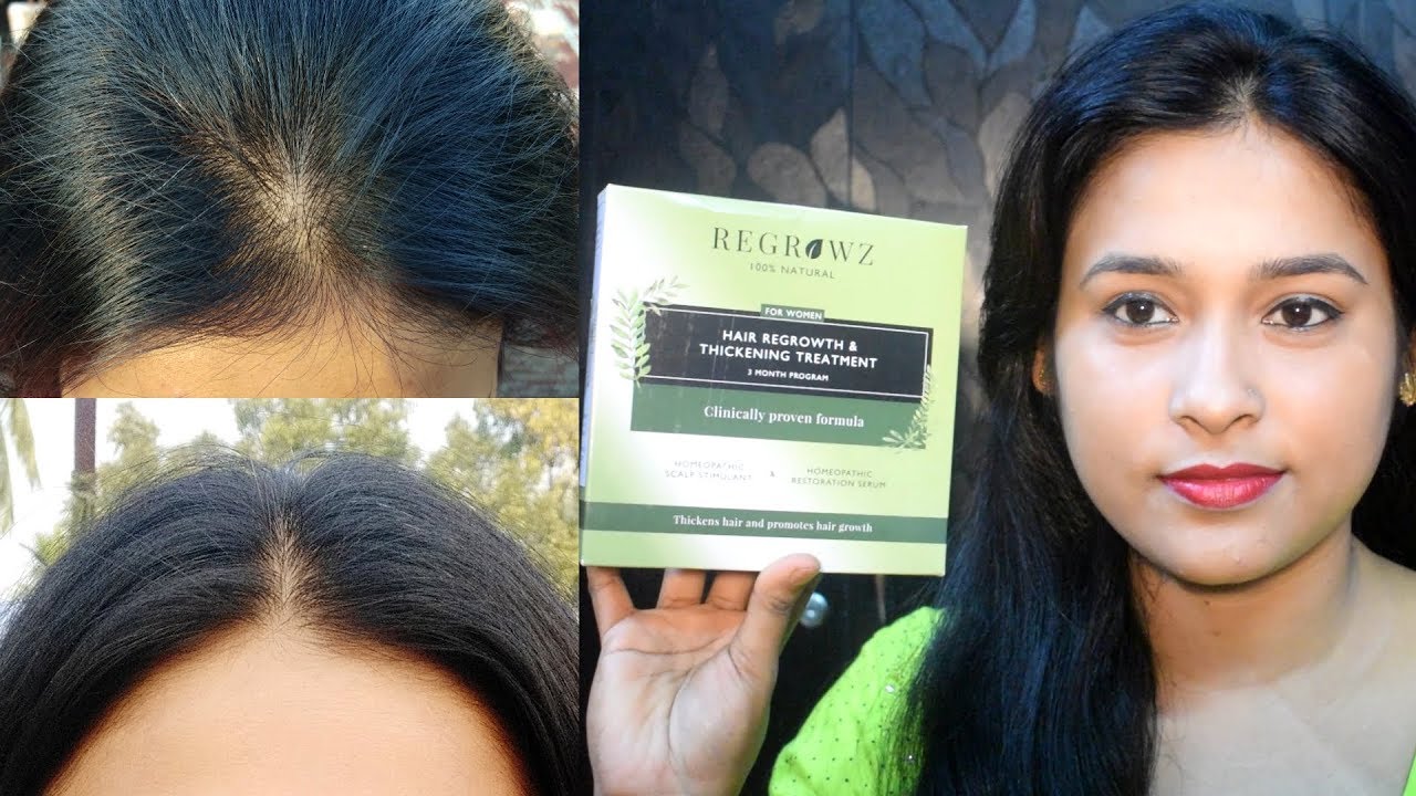 How I Got My Hair Back Regrow And Thicken Your Hair In Natural