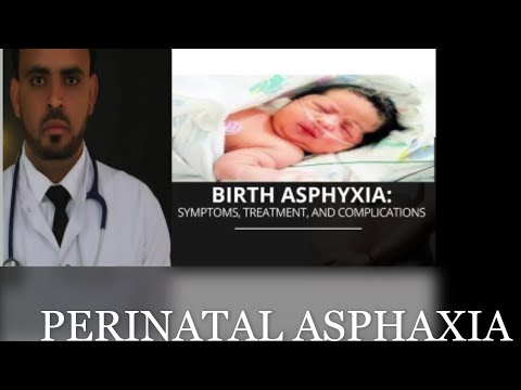 Perinatal Asphyxia