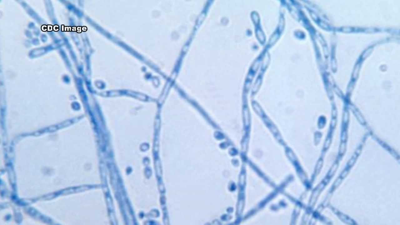 Cladosporium: An Indoo...