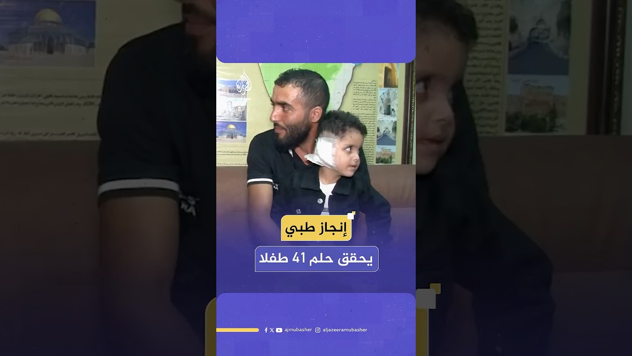 إجراء 41 عملية زراعة قوقعة سمعية لأطفال لبنانيين وفلسطينيين وسوريين في صيدا بجنوب لبنان