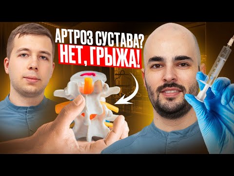 Редкая Грыжа В Пояснице || Резорбция И Лечение!