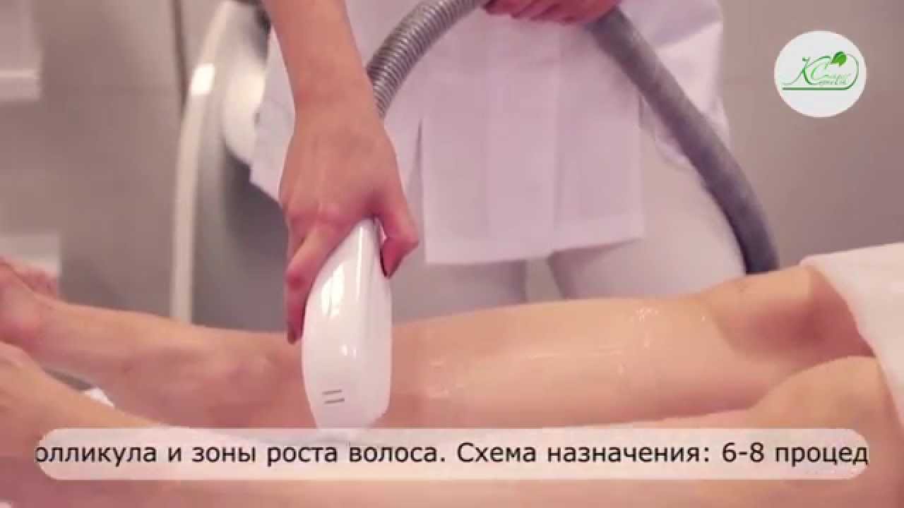 Элос-омоложение, Элос-эпиляция в Клинике "Косметик Центр"