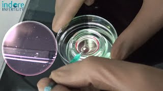 Frozen Embryo Tansfer (FET) - How are Embryos Warmed ( Thaw) in IVF Lab. FET Procedure Step By Step.