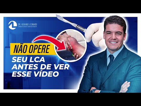 Não Opere seu LCA Antes de Ver esse Vídeo - Dr Adriano Leonardi